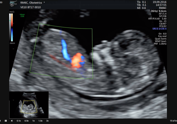 Baby Scans | Chequers Healthcare